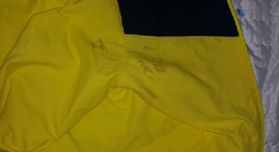 아웃동 이염.png 아웃동 이염.png