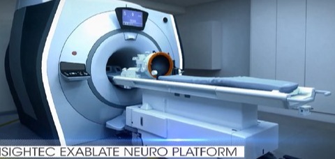 이스라엘 생명공학 기업 인사이텍이 개발하고 휴온스가 국내에 유통 중인 엑사블레이트 뉴로