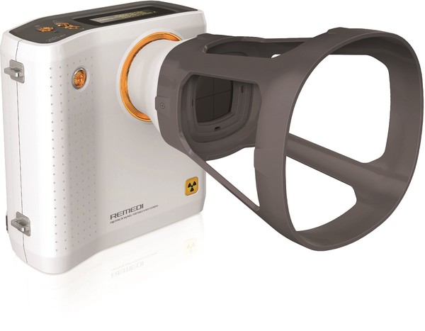 ▲모바일 엑스레이(X-ray) '레멕스'